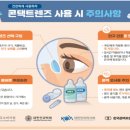김콘택트렌즈 이미지