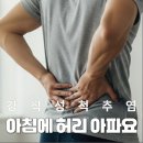 방촌내과의원 | 아침마다 허리가 뻣뻣한 이유? 2030 남성 허리통증 원인, 강직성 척추염 증상과 자가진단