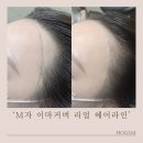 체인지헤어라인 네이버블로그