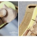 동은치과기공소 이미지