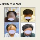 미지예광주
