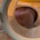 광양시보건소 | [제왕 후기]쫄보 엄마의 광양미래병원 제왕절개 후기및 가격