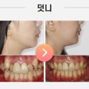 바른웅치과의원 이미지