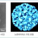 노로바이러스 원인과 초기증상 전염 치료 이미지