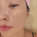 백현동555-2 | 주근깨 여드름 한 번에 해결하는 판교 백현동 올가드림뷰티