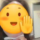 아비쥬 수원 - 윤곽주사/이마 보톡스 후기 [전/후 사진 공개]