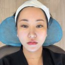 온다호텔(ONDA HOTEL) | 강남역피부과 프리미엄 온다리프팅 6만줄 솔직 후기 통증 마취