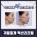 매하관 이미지