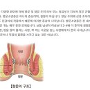 한솔학문외과의원 네이버블로그