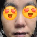 코어텍 | 바이오힐보 프로바이오덤 3D 리프팅 L-PDRN 크림 솔직 사용 후기