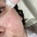 (주)신동부종합정비 | 합정피부과 볼뉴머리프팅 1+1 파격 이벤트 힐스 6월 프로모션♥