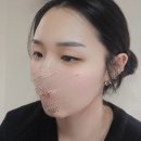 더자연스러움 | 성신여대 반영구 자연스러움, 만족스러운 후기