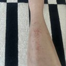 메디칼바른약국 | [피부보약]샵벨르