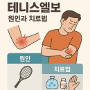 [일원2] 밴드 하나로 지키는 건강관리법 | 테니스엘보 치료법