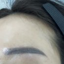 나루텍 | 마곡역잔흔제거 ‘비브 에스테틱 서울 마곡본점’ 눈썹 리셋 솔직후기