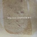 상복부 발진성 연모낭종(피지낭종)제거 후기
