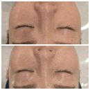 뚜레쥬르(김해진영점) | 진영에서 피부관리받으러 간 썰 풉니다 (세멘시트) "뷰티브레스"
