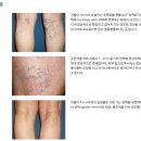 뉴하트의원 네이버블로그