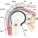 라임나무한의원 네이버블로그