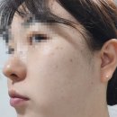 세안@ | 엔카 약알칼리성 클렌징폼 아침 세안 후기