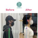 휴자세교정 이미지