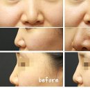 해피아이안과의원 이미지