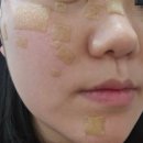 고일약국 | 면목동기미잡티제거 후 관리방법이나 주의사항 정리해봄!