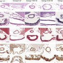 Re: mircocurrent 치료기 - 동맥의 기형을 개선한다 2024 natrue 이미지