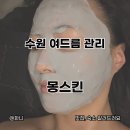 1366 | 수원 망포 여드름 관리 몽스킨 써큘테라피 후기