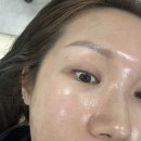 구로-구로-구로-606 | 구로 아이라인 제거 1회로 달라진 변화! 미작뷰티구로점 방문 후기