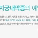 여성미한의원 네이버블로그