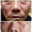 라온인셀덤 네이버블로그