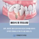 미래이치과의원 네이버블로그