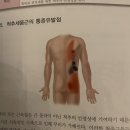 혜스테틱