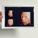 은혜허브다이어트 | 임신 27주차 입체초음파 시기, 비용, 중기 임산부 증상