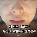 에이엘뷰티