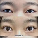 이루다의원 네이버블로그