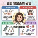 [보령탈모] 대천 시내 원형탈모 극복 후기, 초콜릿헤어샵의 네오나오 두피관리+홈케어 솔루션!