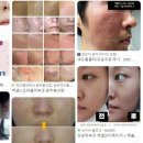 한밭의원 | 대전 동구 피부과 잘하는 곳, 유명한 곳, 리뷰 인기순위 TOP 7