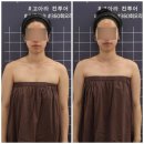 goara(고아라) | [고아라컨투어샵]전주 작은얼굴관리 추천, 얼굴과 자세를 함께 보는 보라윤곽테라피 후기