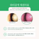 축농증 수술 미뤄뒀다간 어떤 일이 발생할지도 몰라요