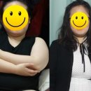F59 | [비니콩즈 후기]한달째 경과 보고♥