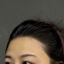 657헤어 | 강남 정수리두피채움 전문 [위브로] 자연스러운 헤어라인 교정 후기