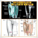 피부가려움증과 생리통 체기가 있을 때 혈해(血海)혈 이미지