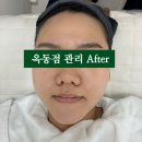 울산 피부관리 문제성피부는 올가드림뷰티 옥동점