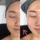 돌봐줄개 | 신림동피부관리 듀엘에스테틱 이중턱 브이라인 EMS 티리온엑스 솔직후기