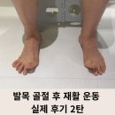 CT휘트니스 | [연신내 헬스장] 발목 골절 후 재활 운동 실제 후기 2탄