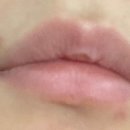 르에이치의원 이미지