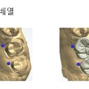 월드치과기공소 이미지