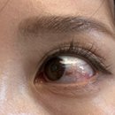 혜안서울안과의원 이미지